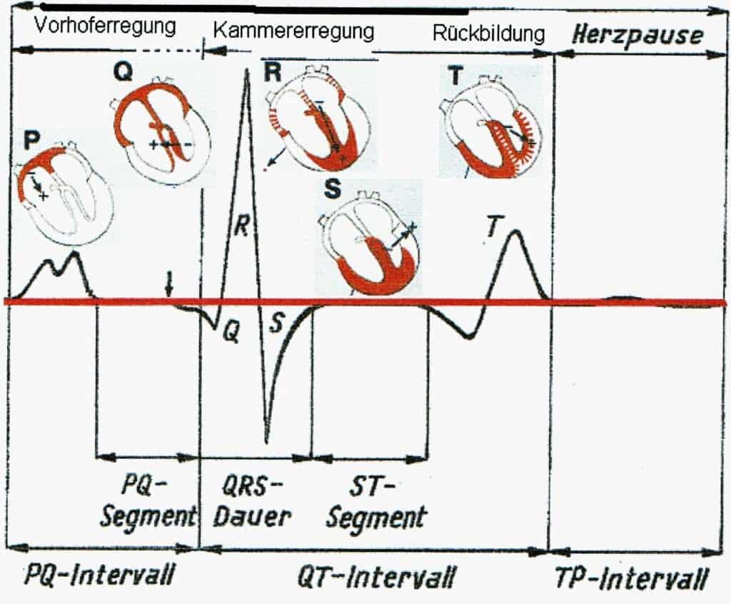 Elektrokardiogramm 1 Abb.: EKG und Erregungszustand der Herzmuskulatur (modifiziert nach Bartels, 1987: Physiologie. Verlag Urban & Schwarzenberg)